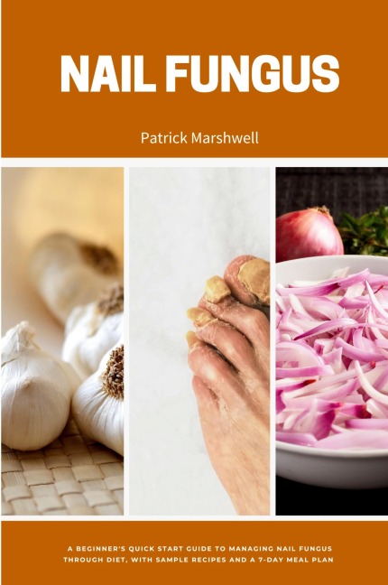 Nail Fungus: A Beginners Quick Start Guide to Managing Nail Fungus Through Diet, With Sample Recipes and a 7-Day Meal Plan