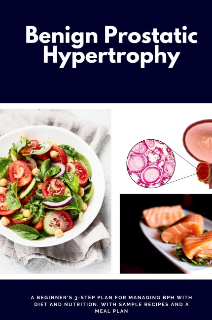 Benign Prostatic Hypertrophy: A Beginners 3-Step Plan for Managing BPH with and Nutrition, with Sample Recipes and a Meal Plan