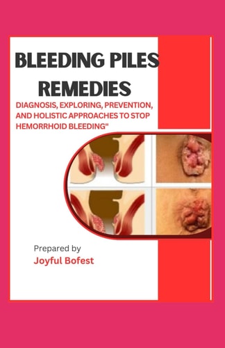 Bleeding Piles Remedies "Diagnosis, Exploring Prevention, and Holistic Approaches to Stop Hemorrhoid Bleeding"