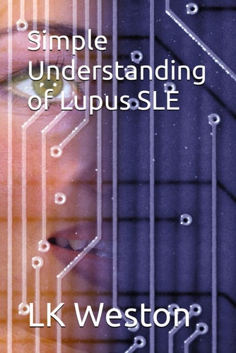 Simple Understanding of Lupus SLE