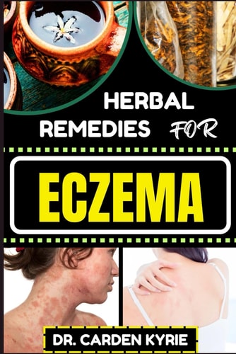 Herbal Remedies for Eczema Unlocking Nature's Healing Power With Herbs For Flourishing Skin, Holistic Wellness, Lasting Relief And Healthy Lifestyle
