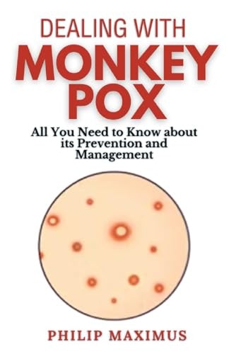 Dealing with MonkeyPox All You Need to Know about Its Prevention and Management