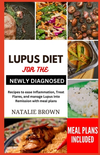Lupus Diet for the Newly Diagnosed Recipes to Ease Inflammation, Treat Flares and Manage Lupus Into Remission with Meal Plans