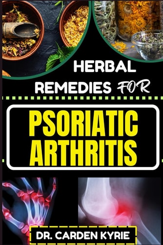 Herbal Remedies for Psoriatic Arthritis Empower Your Journey To Wellness With Herbs For Alleviating Pain, Restoring Joint Health And Nurturing Overall Well-Being
