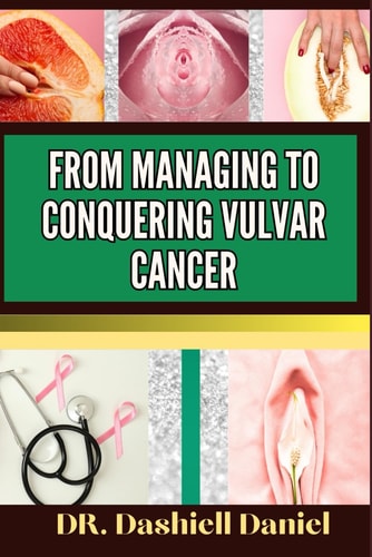 From Managing to Conquering Vulvar Cancer Expert Guide To Understanding Vulvar Cancer, Unveiling Causes, Recognizing Symptoms, and Embracing Effective Treatments for a Journey to Healthy Living