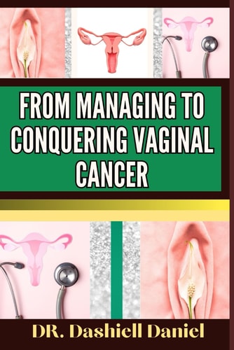 From Managing to Conquering Vaginal Cancer Expert Guide To Understanding The Causes, Recognizing Symptoms, And Navigating Treatment For A Path To Healthy Living