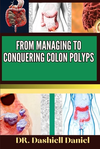 From Managing to Conquering Colon Polyps Expert Guide To Colon Polyps Causes, Symptoms, Treatment, And Achieving Complete Wellness