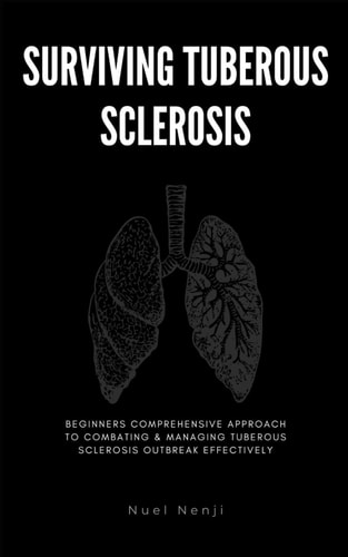 Surviving Tuberous Sclerosis Beginners Comprehensive Approach To Combating & Managing Tuberous Sclerosis Outbreak Effectively