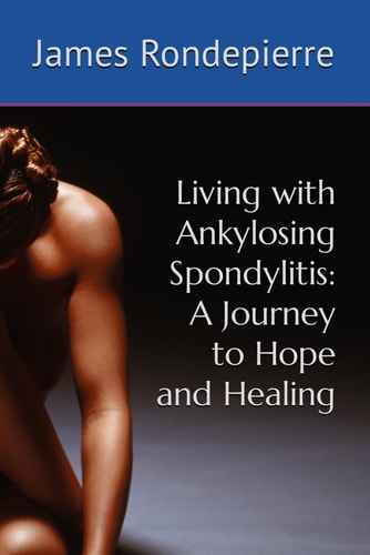Living with Ankylosing Spondylitis A Journey to Hope and Healing