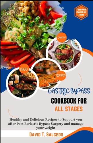 Gastric Bypass Cookbook for All Stages Healthy and Delicious Recipes to Support You After Post Bariatric Bypass Surgery and Manage Your Weight
