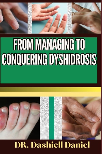 From Managing to Conquering Dyshidrosis Expert Guide To Understanding the Causes, Recognizing Symptoms, Prevention and Embracing Effective Treatments for a Vibrant and Healthy Life