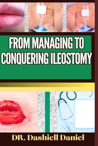 From Managing to Conquering Ileostomy Expert Guide To Understanding the Causes, Recognizing Symptoms, Prevention and Embracing Effective Treatments for a Vibrant and Healthy Life