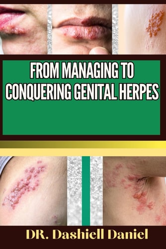 From Managing to Conquering Genital Herps Expert Guide To Understanding the Causes, Recognizing Symptoms, Prevention and Embracing Effective Treatments for a Vibrant and Healthy Life