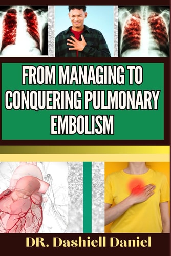 From Managing to Conquering Pulmonary Embolism Expert Guide To Understanding the Causes, Recognizing Symptoms, Prevention and Embracing Effective Treatments for a Vibrant and Healthy Life