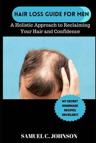 Hairloss Guide for Men A Holistic Approach To Reclaiming Your Hair and Confidence. With My Secret Natural Home-Made Remedies for Hairloss Unveiled!