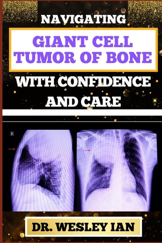 Navigating Giant Cell Tumor of Bone with Confidence and Care Empowering Strategies And Unveiling The Path For Quick Approach To Bone Healing For Healthy Relief