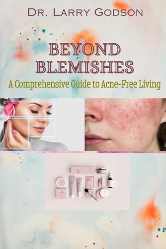 Beyond Blemishes A Comprehensive Guide to Acne-Free Living/ Skincare Bible for Radiant Skin