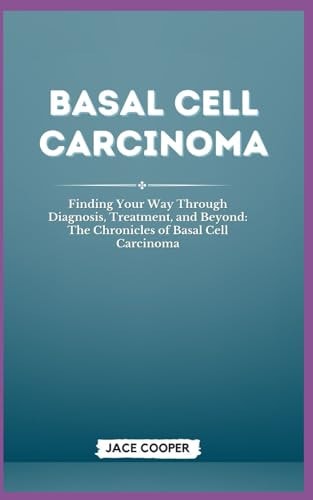 Basal Cell Carcinoma Finding Your Way Through Diagnosis, Treatment, and Beyond: The Chronicles of Basal Cell Carcinoma