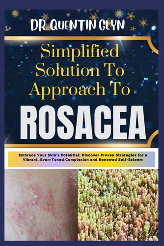 Simplified Solution Approach To ROSACEA Embrace Your Skin's Potential: Discover Proven Strategies for a Vibrant, Even-Toned Complexion and Renewed Self-Esteem