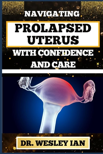 Navigating Prolapsed Uterus with Confidence and Care Discovering Resilience And Empowering Solutions For Confronting Challenges For A Healthy Reproductive System