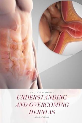 Understanding and Overcoming Hernias A Patient's Guide