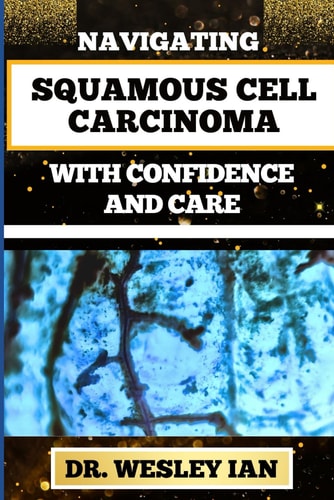 Navigating Squamous Cell Carcinoma with Confidence and Care Empowering Strategies And Finding Strength For Confronting Cell Cancer For Holistic Recovery And Emotional Well-Being