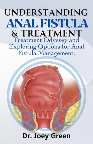 Understanding Anal Fistula & Treatment Treatment Odyssey and Exploring Options for Anal Fistula Management.