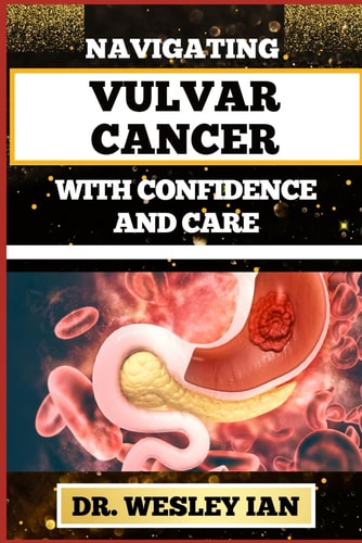 Navigating Vulvar Cancer with Confidence and Care Empowering Insights And Strategies For Confronting Cancer Health Challenges For Female Genitals Recovery