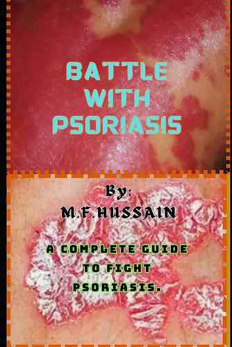 Battle with Psoriasis Complete Guide to Fight Psoriasis