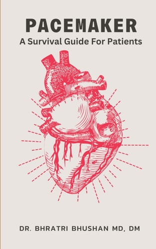 Pacemaker A Survival Guide For Patients