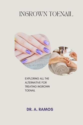 Ingrown Toenail Exploring All the Alternative for Treating Ingrown Toenail