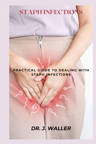 Staph Infections Practical Guide to Dealing with Staph Infections