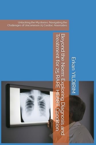 Beyond the Norm Exploring Diagnosis and Treatment for 25 RARE HEART Condition: Unlocking the Mysteries: Navigating the Challenges of Uncommon 25 Cardiac Anomalies