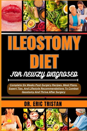 Ileostomy Diet for Newly Diagnosed Complete Six Weeks Post-Surgery Recipes, Meal Plans, Expert Tips, And Lifestyle Recommendations To Combat Ileostomy And Thrive After Surgery