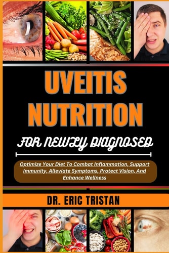 Uveitis Nutrition for Newly Diagnosed Optimize Your Diet To Combat Inflammation, Support Immunity, Alleviate Symptoms, Protect Vision, And Enhance Wellness
