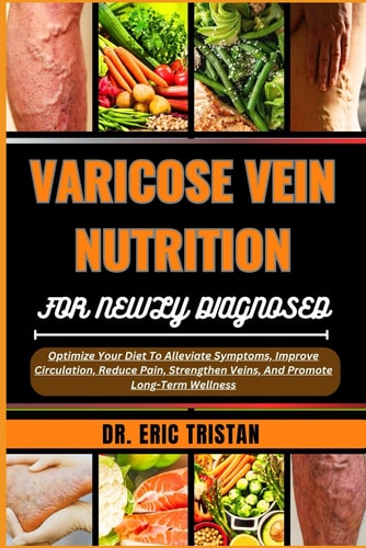 Varicose Vein Nutrition for Newly Diagnosed Optimize Your Diet To Alleviate Symptoms, Improve Circulation, Reduce Pain, Strengthen Veins, And Promote Long-Term Wellness