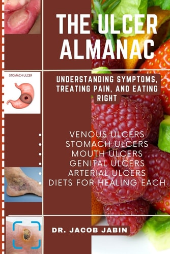 The Ulcer Almanac Understanding Symptoms, Treating Pain, and Eating Right