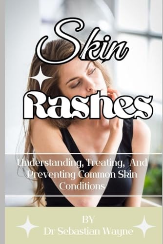 Skin Rashes Understanding, Treating, And Preventing Skin Conditions