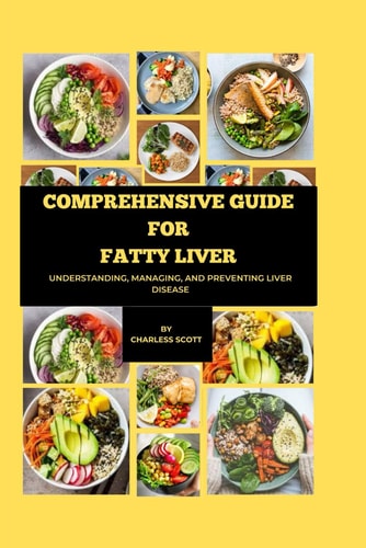 Comprehensive Guide for Fatty Liver Understanding, Managing, and Preventing Liver Disease