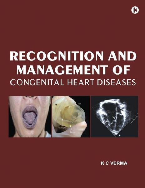 Recognition and Management of Congenital Heart Diseases