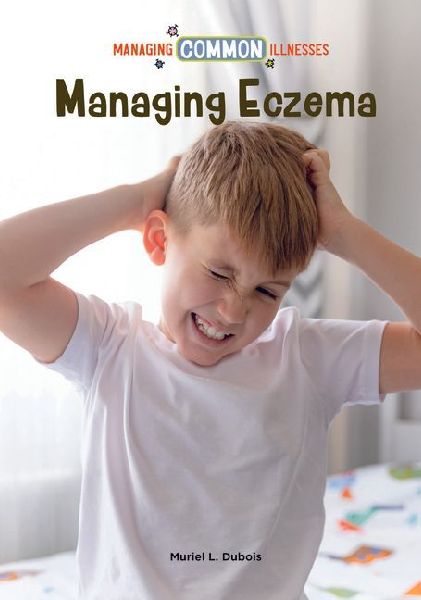 Managing Eczema