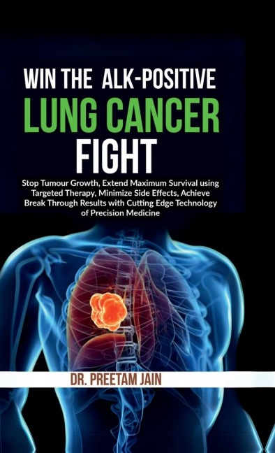 Win The ALK-Positive Lung Cancer Fight: Stop Tumor Growth, Extend Maximum Survival using Targeted Therapy, Minimize Side Effects, Achieve Break Through Results with Cutting Edge Technology of Precision Medicine