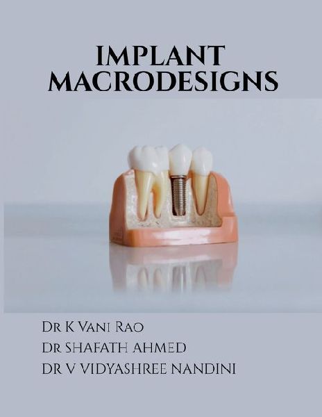 Implant Macrodesigns