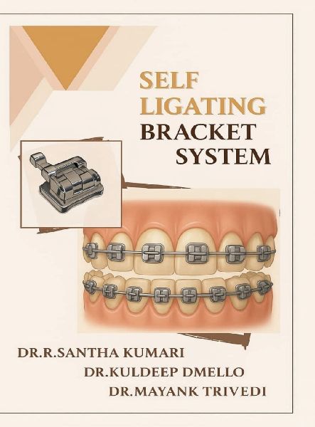 Self Ligating Bracket System
