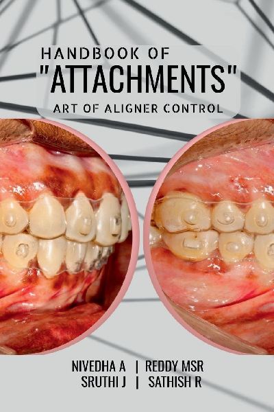Handbook of "Attachments": Art of Aligner Control