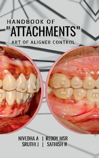 Handbook of "Attachments": Art of Aligner Control