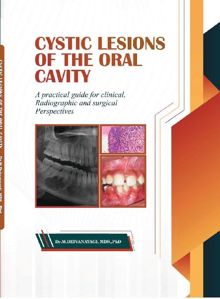 Cystic Lesions of the Oral Cavity: A Practical Guide for Clinical, Radiographic and Surgical Perspectives