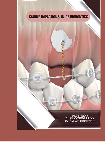 Canine Impactions in Orthodontics