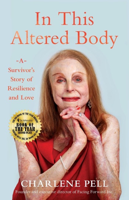 In This Altered Body: A Survivors Story of Resilience and Love